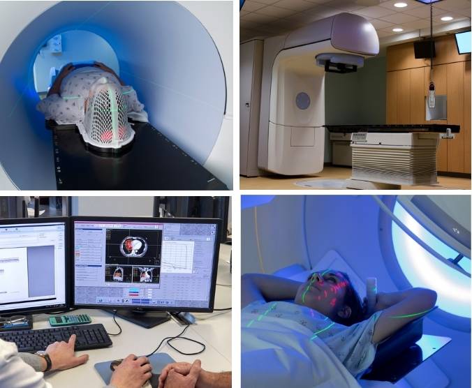 photos de situations pratiques en radiothérapie externe